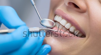 dentist-examining-patients-teeth-600w-364820015-2